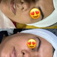 فیشیال و تجویز روتین پوستی اختصاصی رایگان