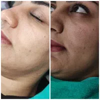 رفع تیرگی بدن/ روشن کننده بدن /زیربغل/بیکینی/صورت|خدمات آرایشگری و زیبایی|اهواز, سپیدار|دیوار