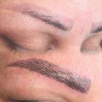 میکروبلیدینگ