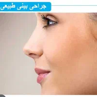 عمل بینی با هزینه مناسب در بندر