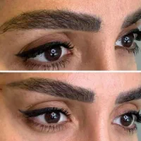 لیفت نخ انزیم ژل وبوتاکس پلاسما تتوبدن فشیال...|خدمات آرایشگری و زیبایی|قم, باجک دو|دیوار