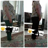 چربی سوزی شکم وپهلو