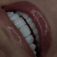دندان پزشکی زیبایی و ترمیمی