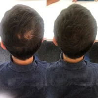 پیازچه رو ریشه‌ای تقویت کن
