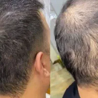 فقط با یک روغن کاژان خودتو زیبا کن