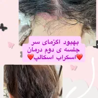 آموزش اسکراب اسکالپ سر به آقایان