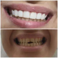 خدمات دندانپزشکی رویال رشت با بهترین کیفیت