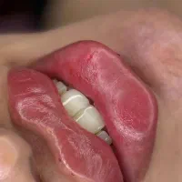 ژل و بوتاکس|خدمات آرایشگری و زیبایی|شیراز, شهرک مهدی‌آباد|دیوار