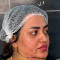 hkvign|خدمات زیبایی و سلامت|اهواز, کیانپارس |دیوار