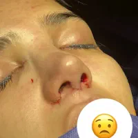 آف ویژه عمل زیبایی بینی ۱۹ میلیون|خدمات آرایشگری و زیبایی|شوش, |دیوار