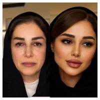 کلینیک تخصصی پوست نخ هایفو لیزر آموزش ژل بوتاکس|خدمات آرایشگری و زیبایی|تهران, زعفرانیه|دیوار