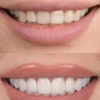 ارائه خدمات  دندانپزشکی با تخفیف ویژه