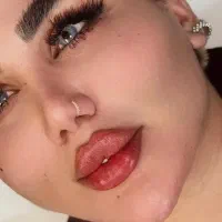 ژل، فیلر، بوتاکس، فیلر بادی، آنزیم با تخفیف ویژه