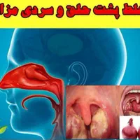 درمان خلط پشت حلق و کبدچرب و استرس و اعصاب