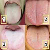 میخوای بدونی عارضه های داخلیت چیه