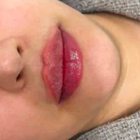 تزریق ژل و بوتاکس در کلینیک زیبایی|خدمات آرایشگری و زیبایی|کرمانشاه, |دیوار