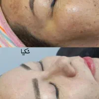 آموزش حرفه ای فیشیال و استخدام در مجموعه ما|خدمات آرایشگری و زیبایی|مشهد, طلاب|دیوار