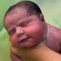 دستگاه زردی به همراه تخت نوزاد و تشک مخصوص کرایه