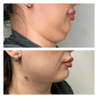 کلینیک تخصصی پوست و مو|خدمات آرایشگری و زیبایی|اهواز, پردیس|دیوار