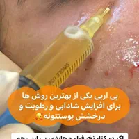 کاشت مــو/لیزر مو زائد/لاغری/فیلر بادی/ نخ بوتاکس|خدمات آرایشگری و زیبایی|شیراز, کیان شهر|دیوار