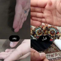 درمان ریشه ای و بدون بازگشت