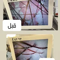 اسکراب اسکالپ(پاکسازی و درمان پوست سر)|خدمات آرایشگری و زیبایی|کرج, مطهری|دیوار