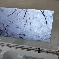 اسکراب اسکالپ،پاکسازی کف سر و فیشال، پاکسازی صورت.