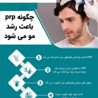prp مو