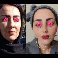 کلینیک زیبایی آشنا