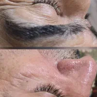 فیشال تخصصی صورت وایتنینگ بدن در کلینیک زیرنظرپزشک|خدمات آرایشگری و زیبایی|اسلامشهر, باغ فیض|دیوار