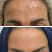 کرم جوانه گندم اصل (با تضمین صددرصد) تخفیف فوری|آرایشی، بهداشتی، درمانی|رشت, پیرسرا|دیوار