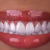 دندانپزشکی خیریه « ایمپلنت عصب کشی کامپوزیت لمینت|خدمات زیبایی و سلامت|قم, مصلاء|دیوار