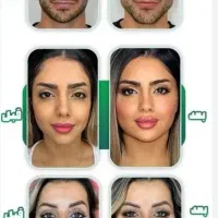 ژل بوتاکس فیلر لاغری هایفو خال لیزر پی ار پی ساکشن