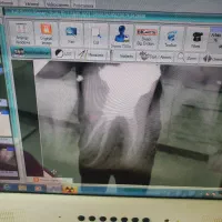 درمان های دندانپزشکی اقساطی ، هزینه بسیار منصفانه