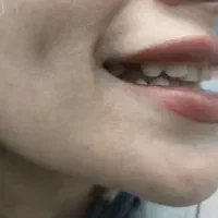 ساخت انواع دندان مصنوعی + لابراتوار دندانساری|خدمات آرایشگری و زیبایی|تهران, یافت آباد جنوبی|دیوار