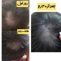 اکسیرپرپشتی مو ،مژه و ابرو|خدمات آرایشگری و زیبایی|گلبهار, شهر جدید گلبهار|دیوار