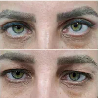 تخفیفات زیبایی و عملهای جراحی|خدمات آرایشگری و زیبایی|دوگنبدان, |دیوار