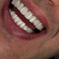 جشنواره پاییزه کامپوزیت شروع شد