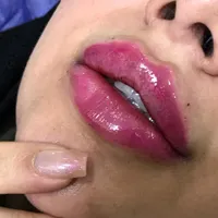 دوره آموزش زیبایی توسط پزشک