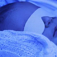 اجاره دستگاه زردی فتوتراپی اقتصادی|پزشکی|هشتگرد, هشتگرد قدیم|دیوار