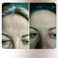 برند لاکچری کوین