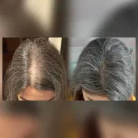 شماهم میتونی یکباره میتونی درمانش کنی