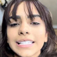 کامپوزیت دندان هرفک فقط۷ملیون ۵۰۰تومن جشنواره یلدا