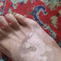 کی گفته خب نمیشی|آرایشی، بهداشتی، درمانی|کرمانشاه, |دیوار
