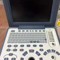دستگاه سونوگرافی epm