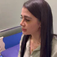 زیبایی بینی با تخفیف ویژه فقط 34تومن تا ۲۹اسفند