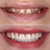تکمیل البوم زیبایی کلیک‌کن|خدمات آرایشگری و زیبایی|قم, زنبیل آباد|دیوار