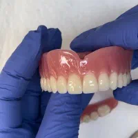 ساخت دندان مصنوعی