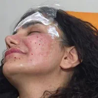 تخفیف ۵۰ درصدی اموزش صفر تا صد ژل و بوتاکس و ...|خدمات آموزشی|تهران, نارمک|دیوار