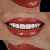 دندانپزشکی از دم قسط ایمپلنت کامپوزیت عصبکشی روکش|خدمات آرایشگری و زیبایی|خرمآباد, |دیوار